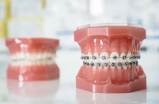 Ортодонтія